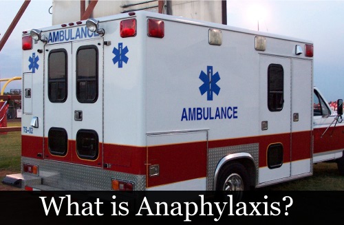 Anaphylaxis and Food Allergies